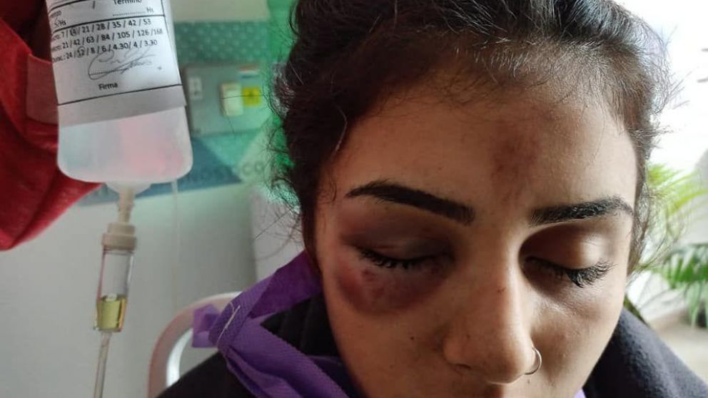 Así quedó la victima luego de ser atacada.