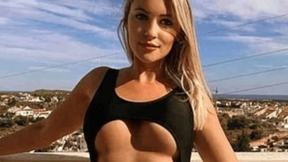 Kylie Biss, la modelo que est� en boca de todos.