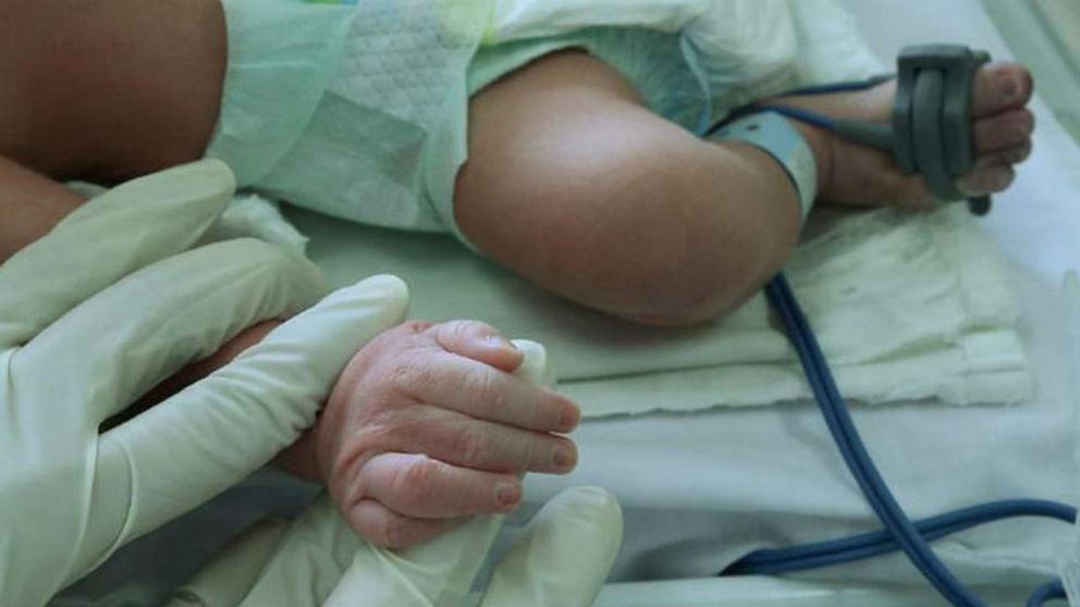 El pequeño, de 35 semanas de gestación, falleció mientras estaba internado en grave estado (Imagen ilustrativa).