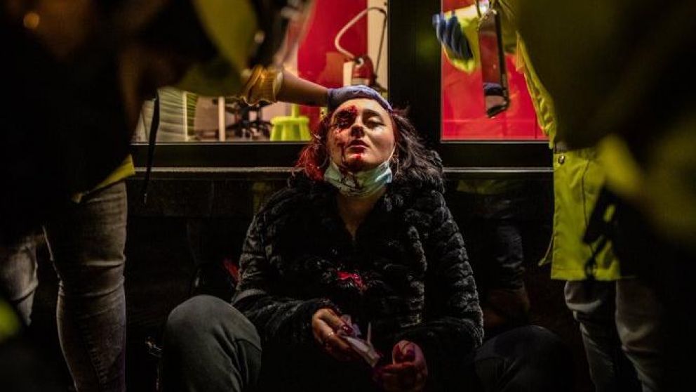 La mujer sufrió una herida que le provocó la pérdida de su ojo.