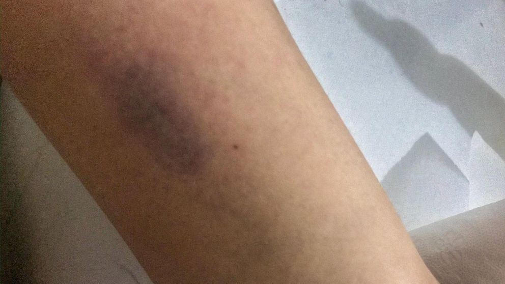 La denunciante subió fotos a su perfil (Twitter).