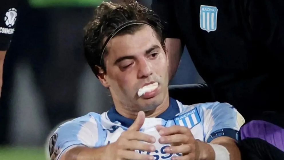 Malas noticias para Racing: Santiago Sosa sufrió una fractura en el rostro y se perdería la vuelta de la Copa Libertadores