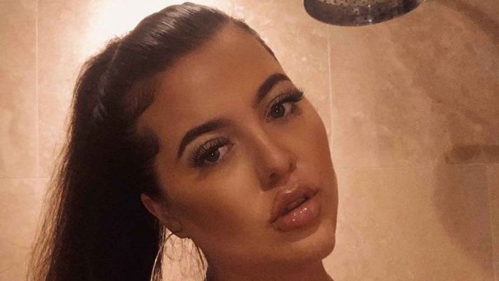 La joven británica estaba "avergonzada" por su condición y quería "sentirse normal"