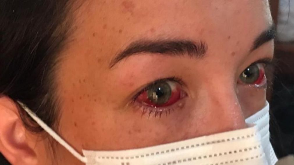 La mujer, que lleva ocho meses de gestación, estuvo internada tres días a raíz de las heridas.