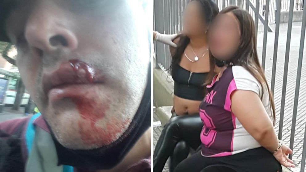 El policía herido por los cascotazos arrojados por las dos mujeres.