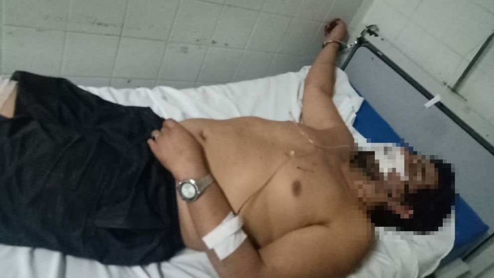 El imputado yace esposado a una cama, luego de haber sido herido de bala en la pierna derecha.