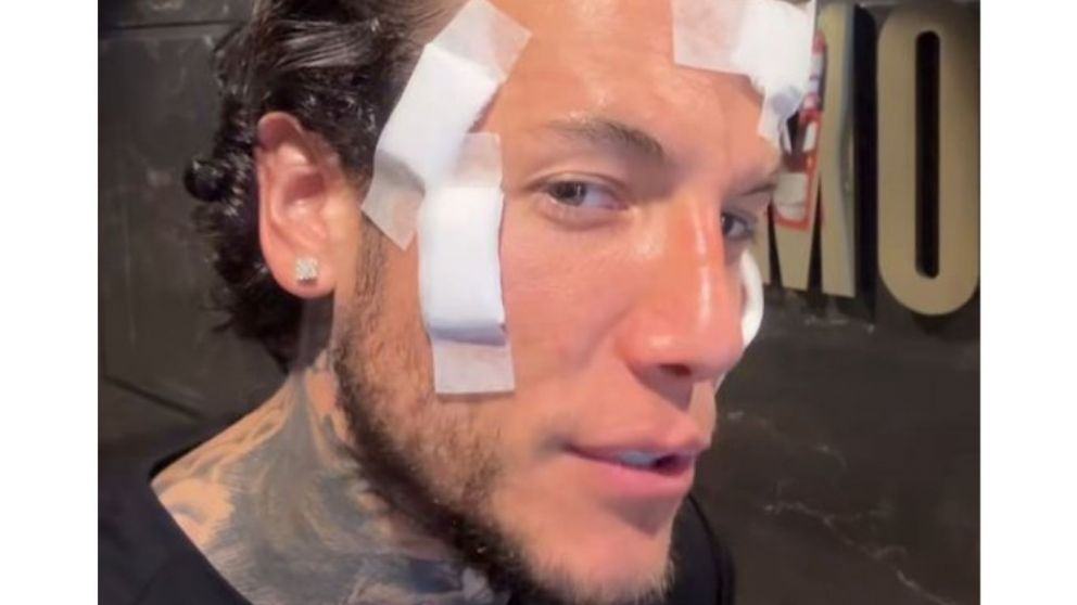 Alex Caniggia se borró sorpresivamente los tatuajes: mirá cómo quedó.