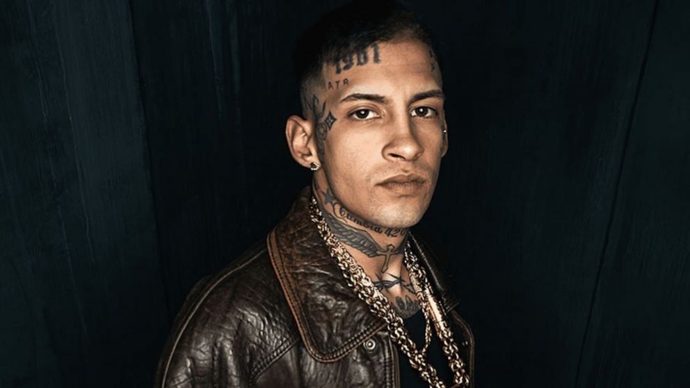 El diagnóstico que recibió L-Gante y lo obliga a alejarse de los escenarios: "Se trata de algo..."