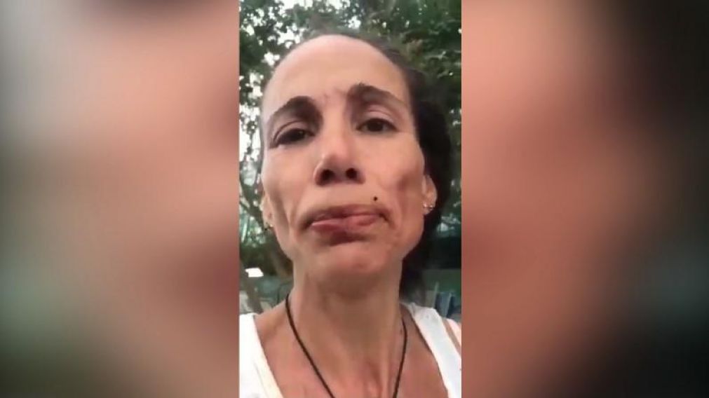En el video se ve a la mujer con el brazo cortado y ensangrentada.