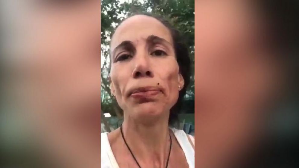 En el video se ve a la mujer con el brazo cortado y ensangrentada.