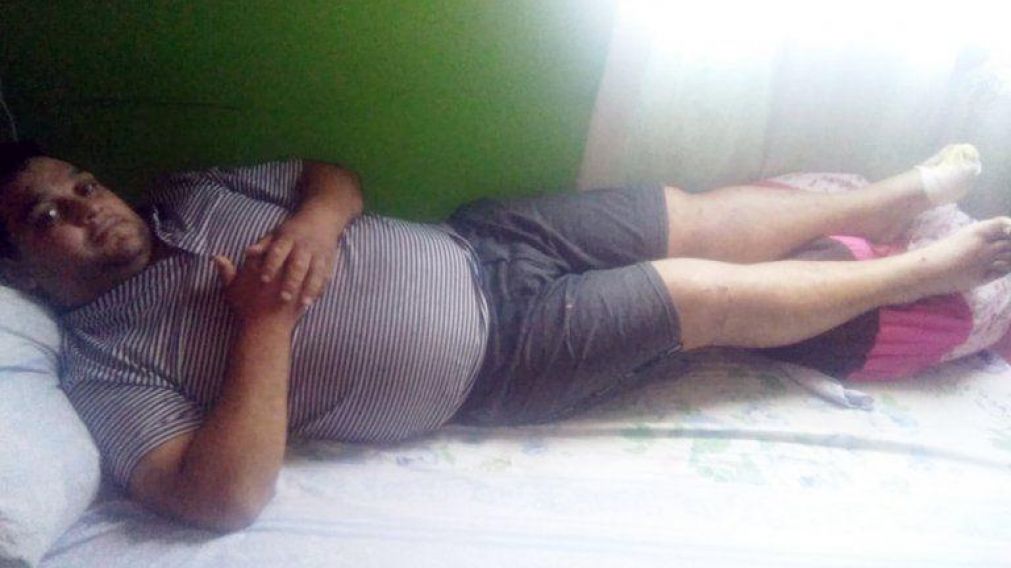 Elías Zuñiga sólo espera que le den el alta médica para poder volver a trabajar.