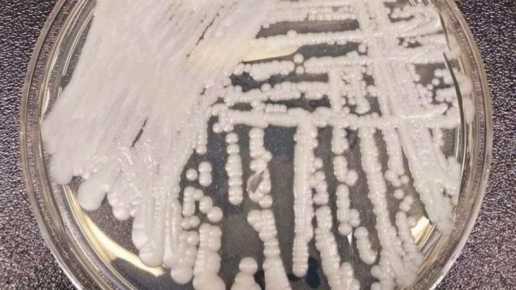 Una cepa de 'Candida auris' cultivada en placa de Petri. (Foto: Reuters)
