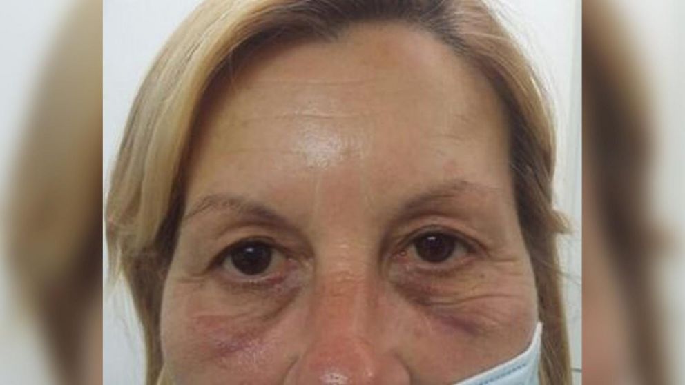 La mujer tuvo contusiones en su cuerpo y sufrió de mareos y náuseas.