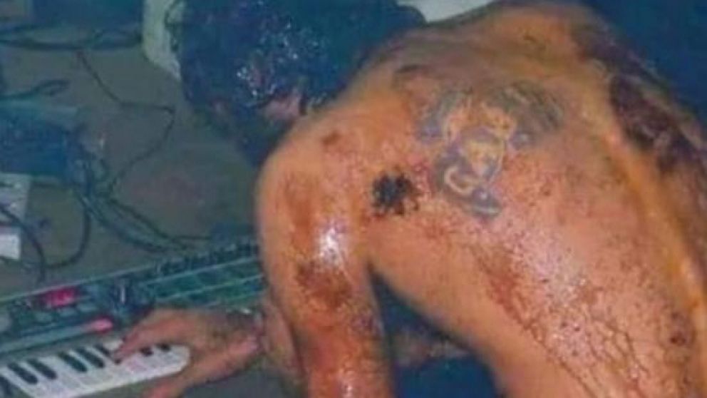 El hombre que logróregresar del infierno