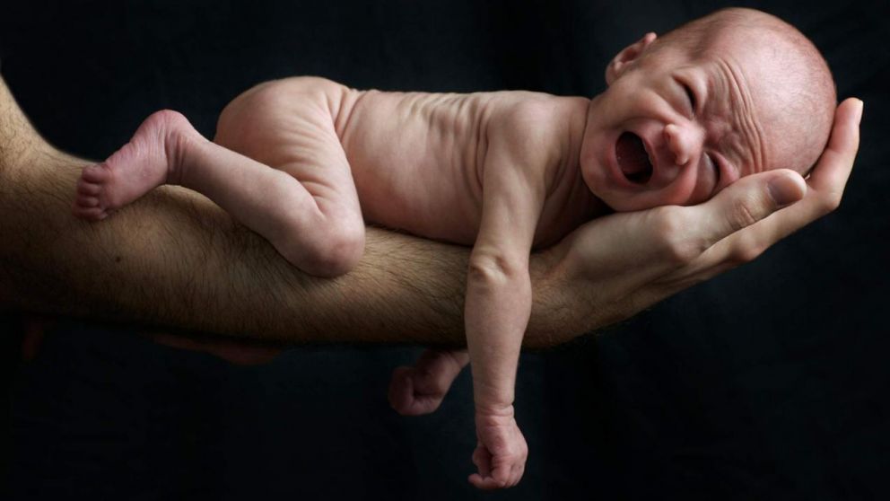 El embarazo normal dura 40 semanas, es decir, más de nueve meses.