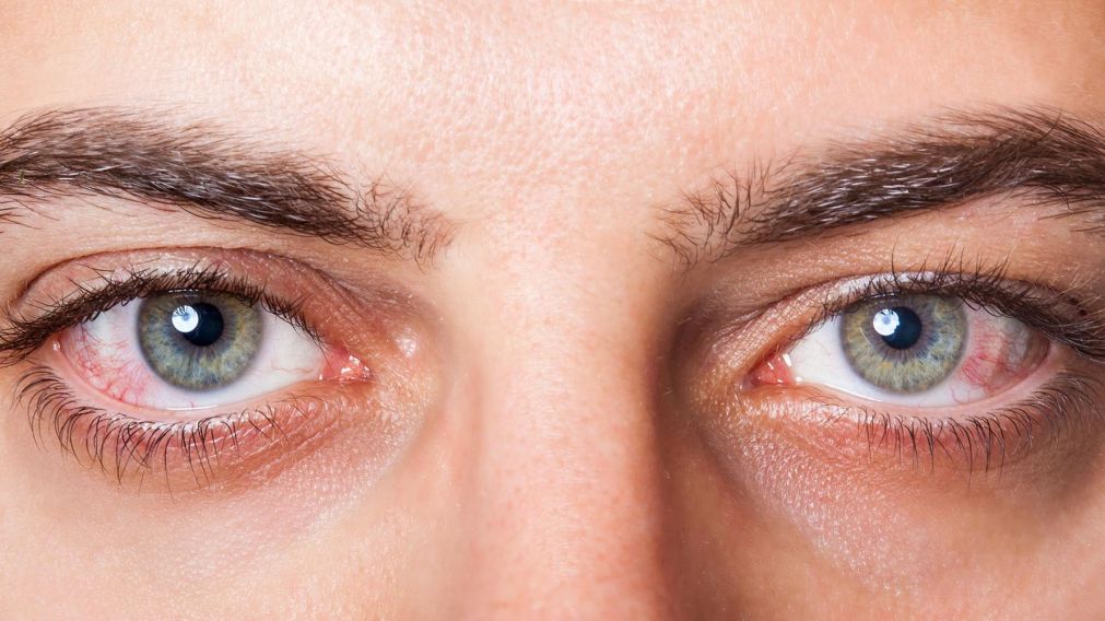 Los ojos podrían darnos indicios de coronavirus (Imagen ilustrativa).