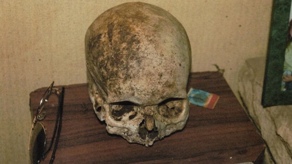 Usaron un cráneo humano como decoración para Halloween.