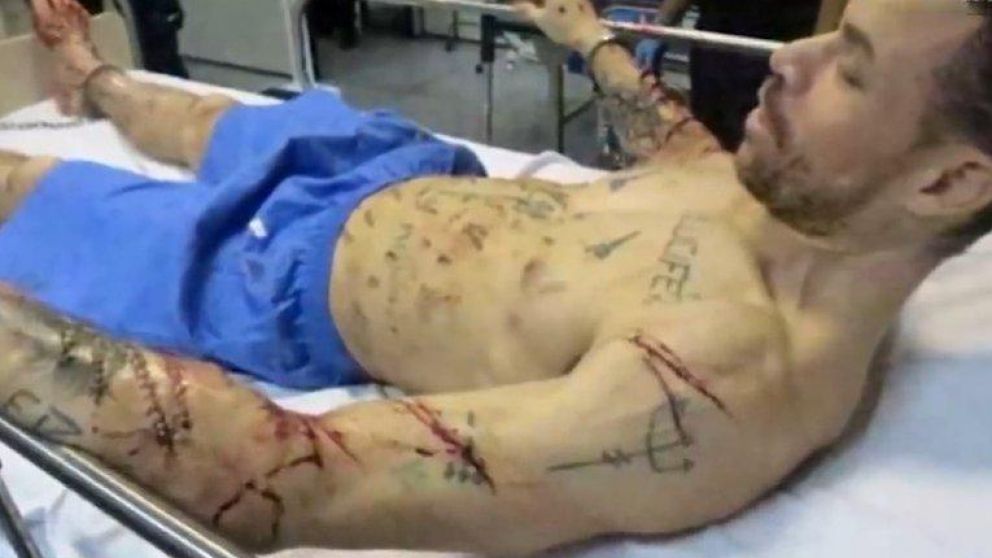 Da Silva se mutiló varias zonas del cuerpo durante un episodio psiquiátrico.