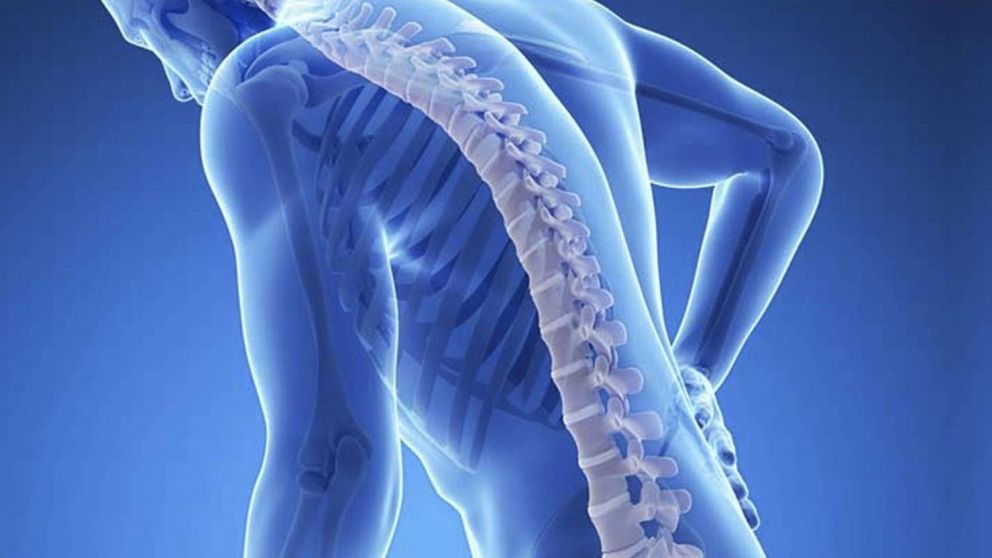 La osteoporosis causa una fractura cada tres segundos a nivel mundial.