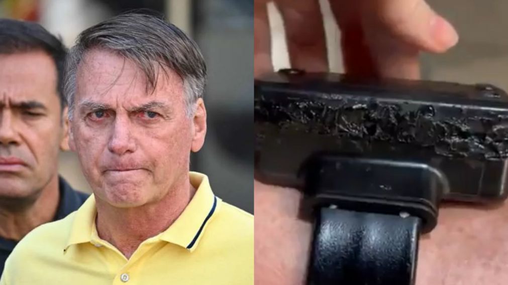 Jair Bolsonaro intentó quemar su tobillera electrónica.