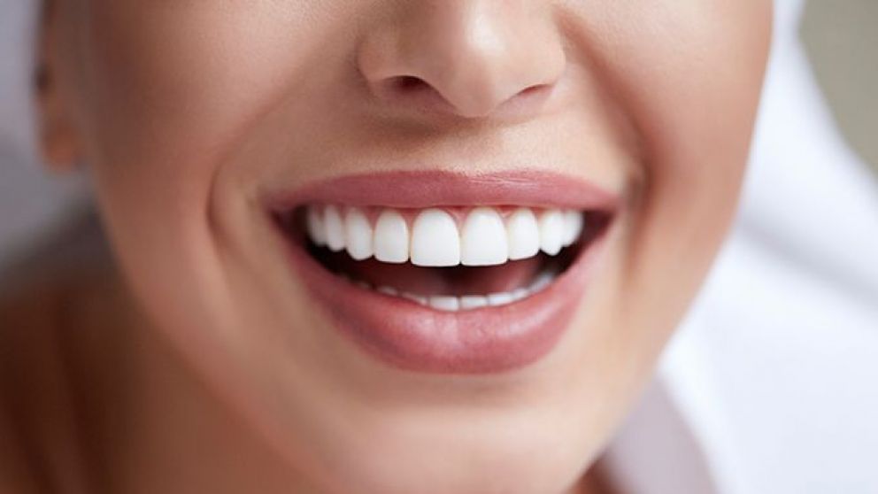 Las sonrisas corren peligro, por esta tendencia de TikTok (Imagen ilustrativa).