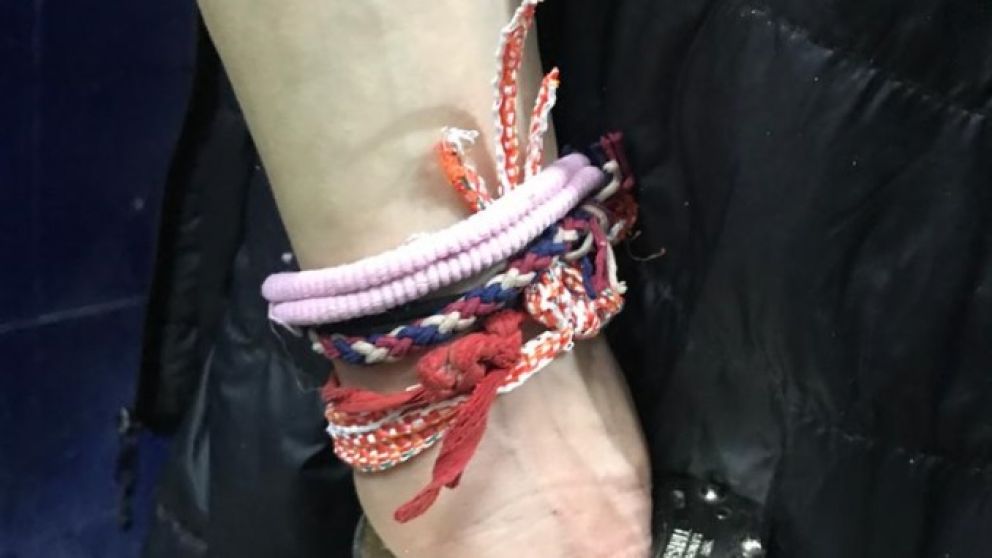 Gracias a esta pulsera, los investigadores policiales reconocieron al peligroso asaltante.