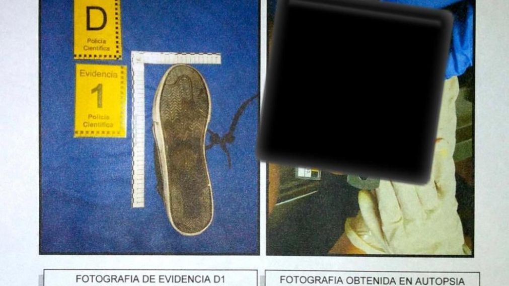 Confirman cu�l fue el rugbier que le peg� la patada en la cara a Fernando B�ez Sosa.