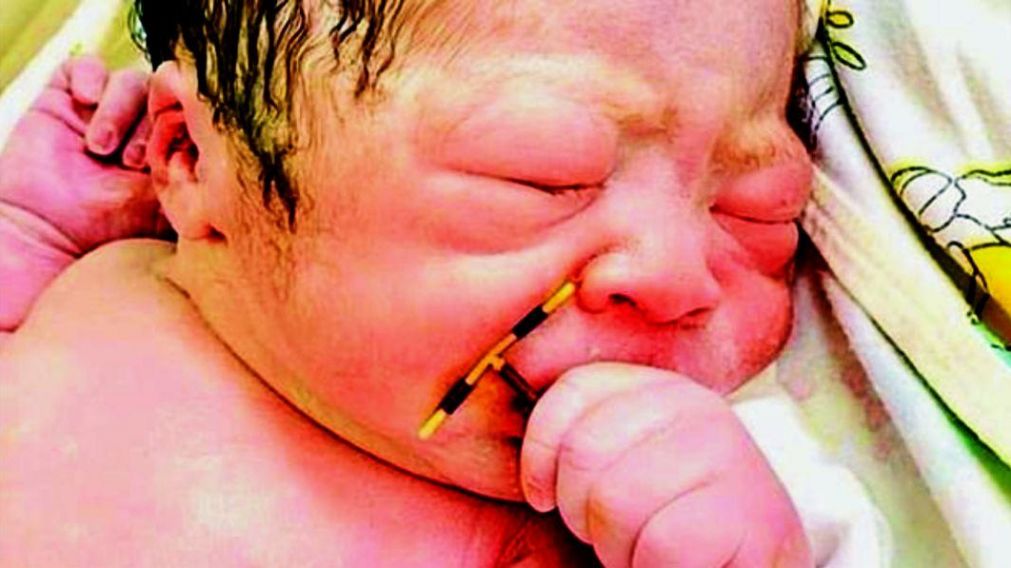El menor naci� en la Maternidad del Hospital Internacional de Hai Phong, en Vietnam.