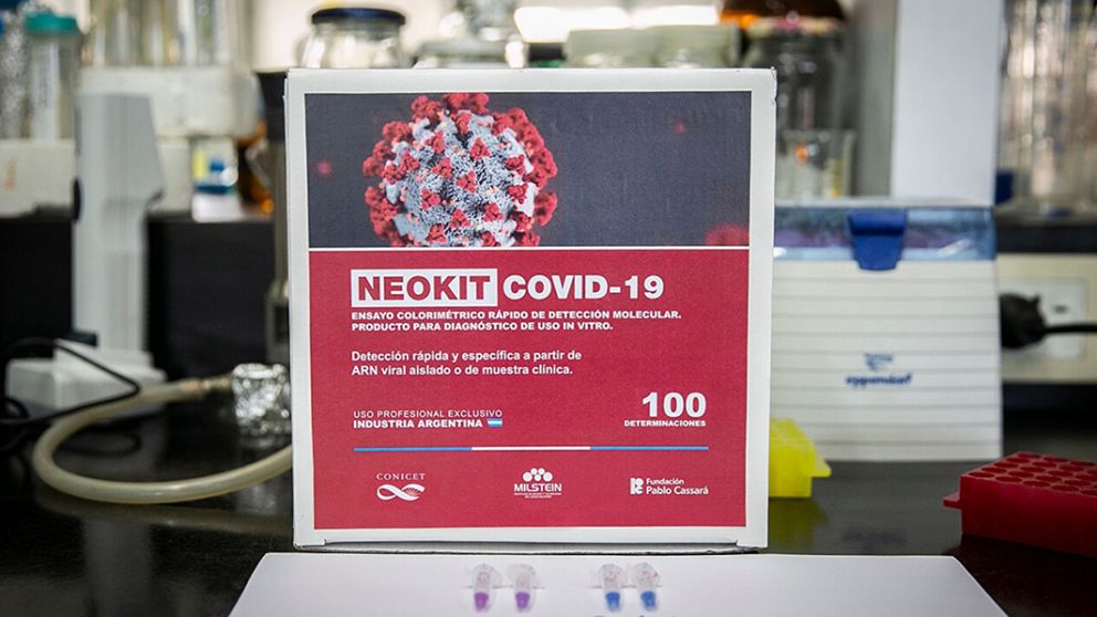 Tests rápidos creados por científicos argentinos ya se distribuyen en hospitales públicos
