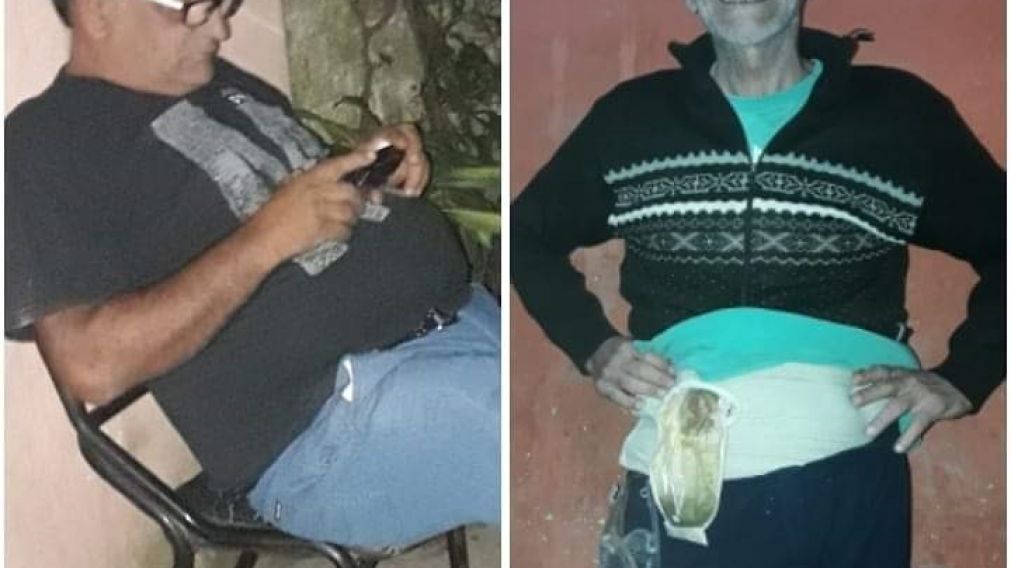 Mario Walter Abraham, antes y después del accidente.