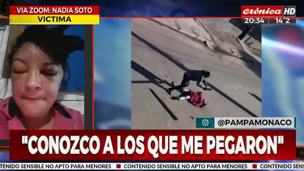 La víctima contó cómo ocurrió la brutal golpiza cuando intentó recuperar el vehículo robado (Crónica HD).