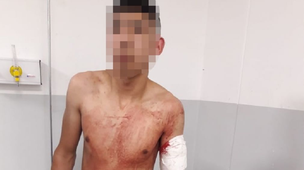 Este es el ladrón que fue herido de bala luego de enfrentarse a disparos con los efectivos policiales.