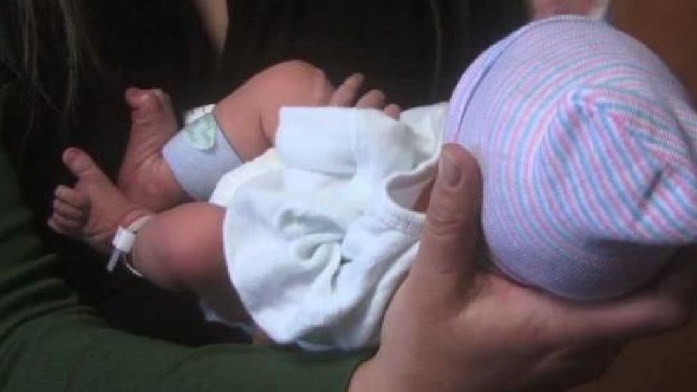 El síndrome del bebé sacudido destruye las células cerebrales del niño. (Foto ilustrativa)