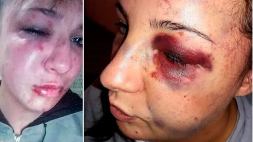 Así dejó Angel Dadeiro a su ex pareja: fue detenido por la policía,