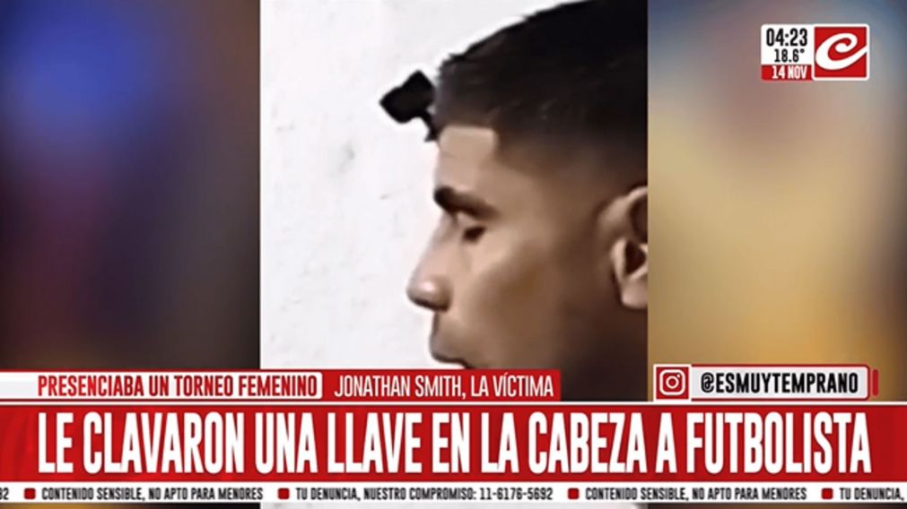 Crónica HD