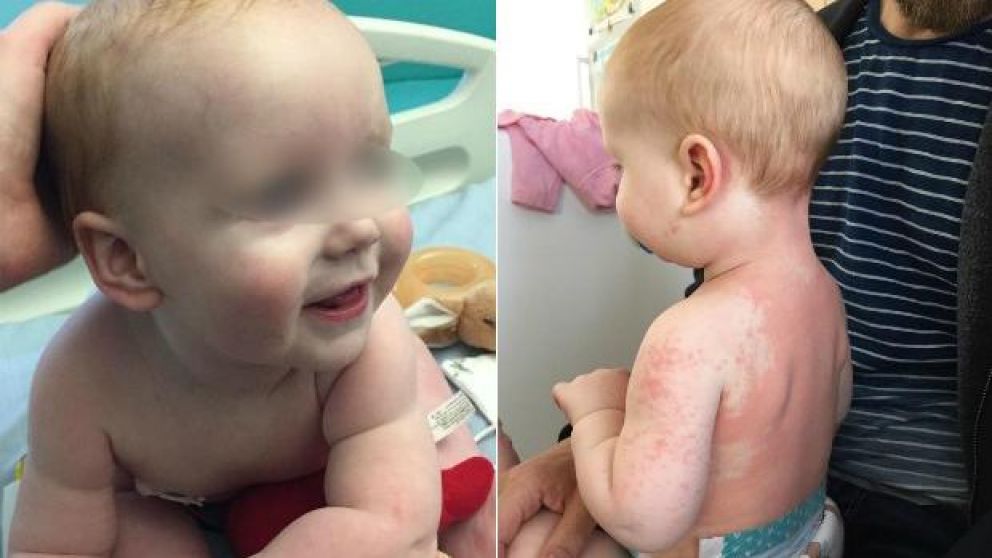 Alexander Parsons, el bebé que perdió la vida producto de la enfermedad.