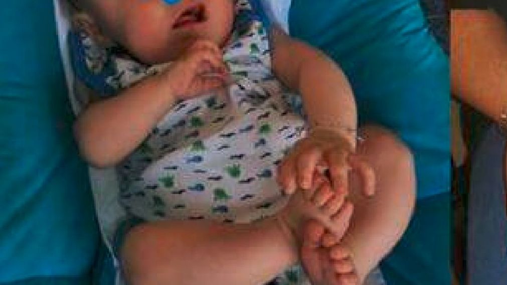 El bebé sin rostro cumplió siete meses y su mamá lo celebró con un tierno álbum de fotos.