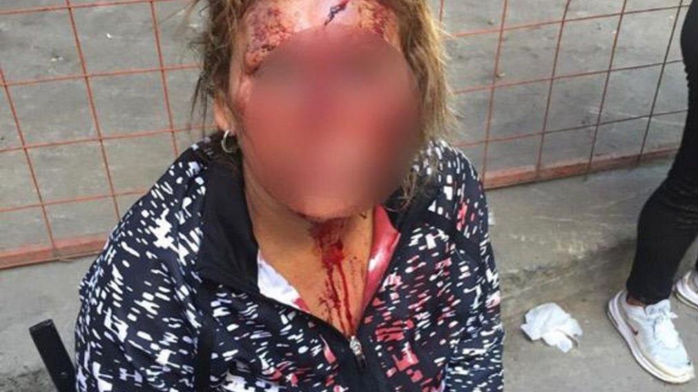 La mujer fue atendida en el Hospital Fernández.
