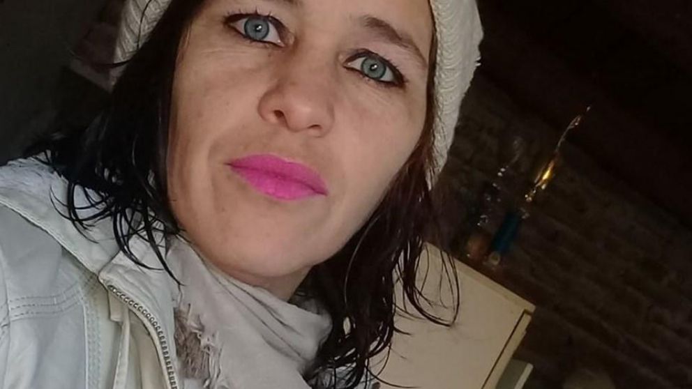 Murió, Romina Videla, la mujer quemada por su pareja.