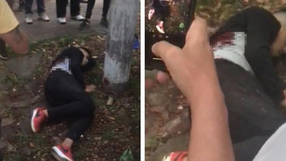 Así quedó herido el homicida. (Captura video)