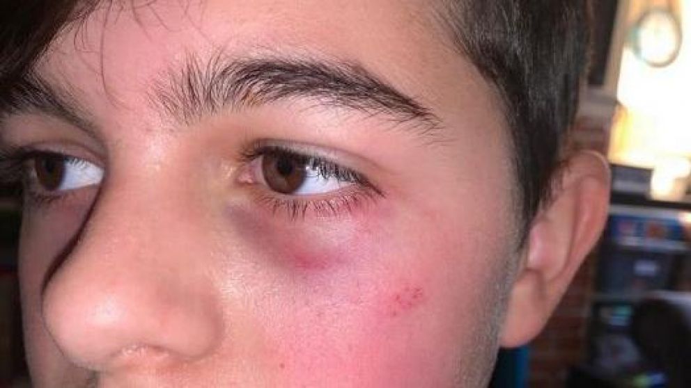 La víctima de 12 años fue golpeado durante casi tres meses.