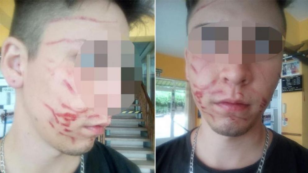 Así quedó el joven tras el brutal ataque. (Gentileza El Doce)