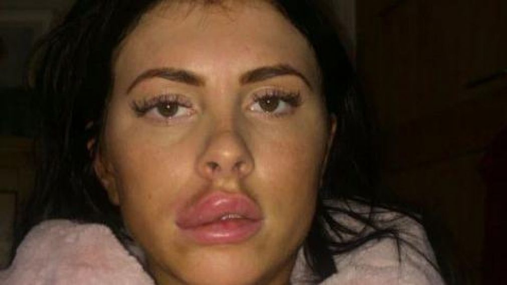 Jessica Myott, de 25 años, fue sometida a una operación de emergencia.
