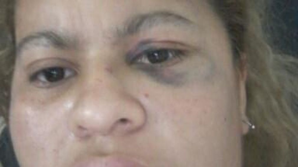 Las marcas de la violencia en el rostro de Antonella. 