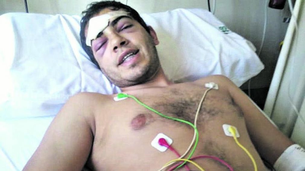 Joven sufri� una fractura de cr�neo tras ser atacado en patota dentro de boliche en Tucum�n.