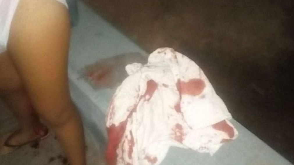 La imagen es elocuente: la joven se tuvo que cambiar el pantalón ensangrentado en la calle (Gentileza El Tribuno)