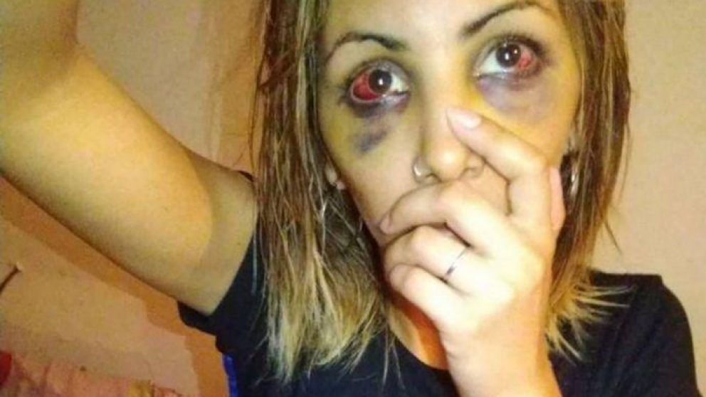 Magalí Lencina denunció a su ex pareja por violencia de genéro.