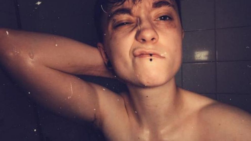 La mujer de 20 años recibió fuertes golpizas por detrás de su cabeza.