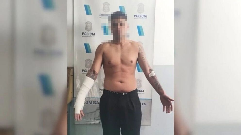 El conductor de la camioneta Amarok que impactó contra el Renault 12, permanece detenido en una dependencia policial.