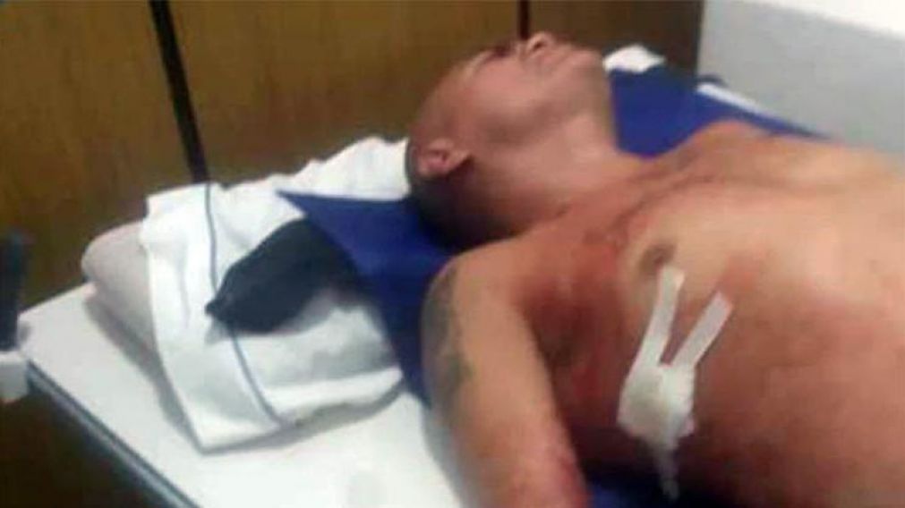 El pugilista fue internado de urgencia con graves heridas.
